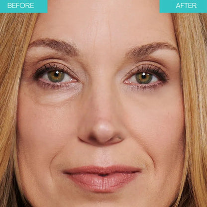 Bright Up - Smooths out wrinkles instantly